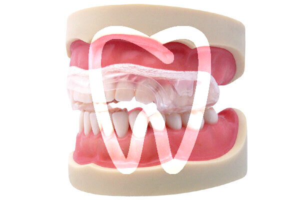 Aqualizer aparatos funcionales dentrade