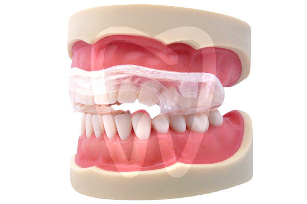 Aqualizer aparatos funcionales dentrade