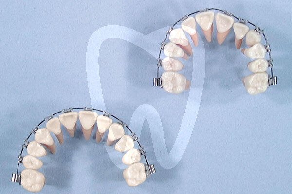 Arcos thermomemoria arcos y alambres leone