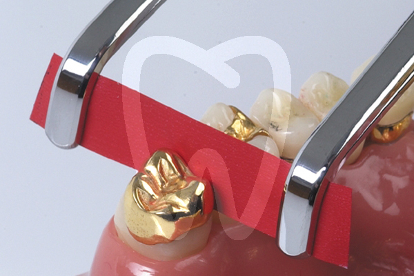 Arti-fol metallic bk35 rojo un lado impresión y prótesis bausch