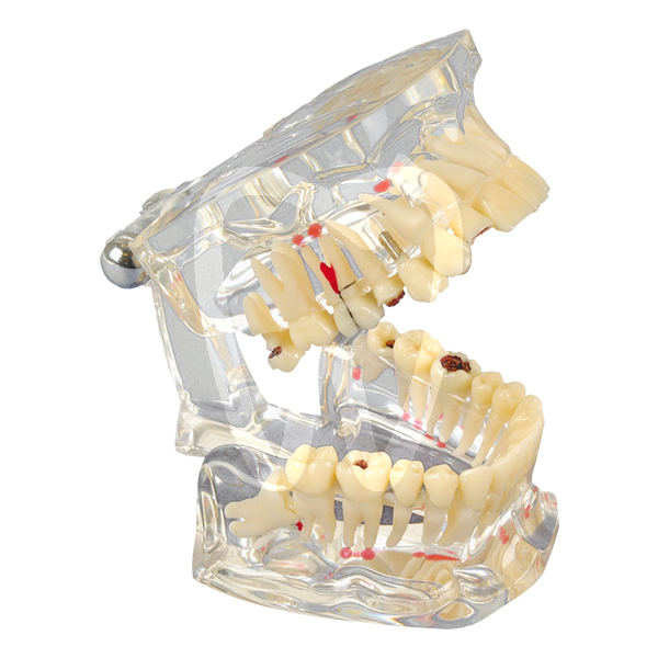 Modelo de estudio transparente deluxe instrumental hager & werken
