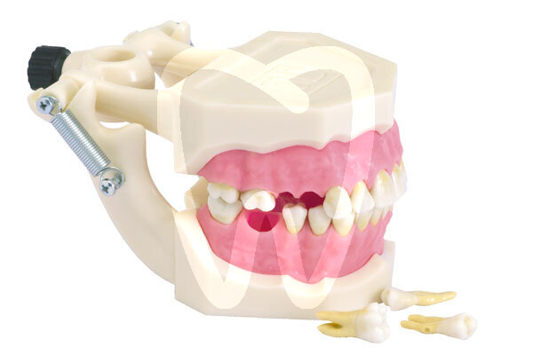 Modelo standard radiculares extraibles instrumental dentalstore