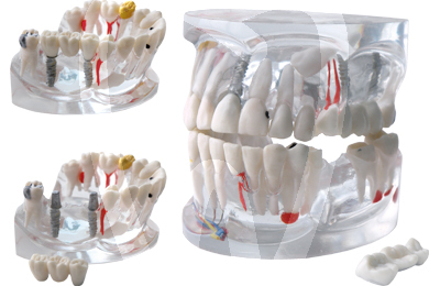 Modelo transparente ds0800 instrumental dentalstore