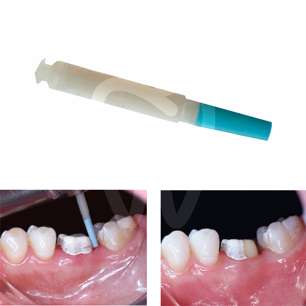 Opticlean cementos kerr