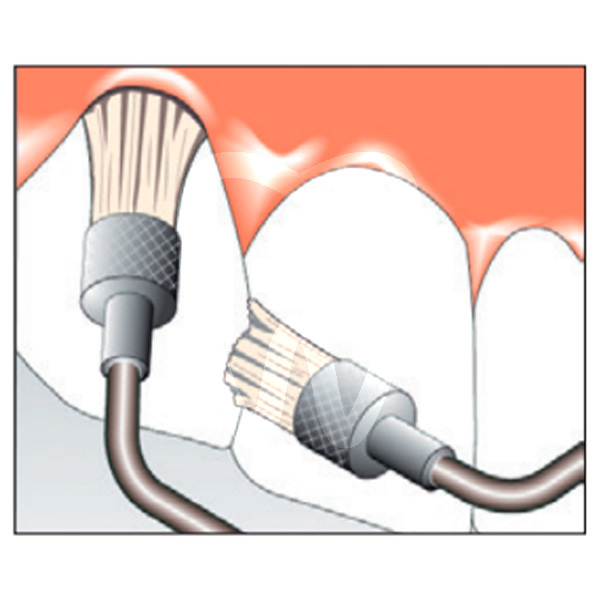 Punta sonicflex ka48b profilaxis kavo