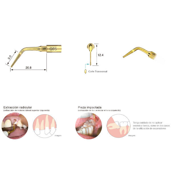 Punta ultrasonidos g95 profilaxis nsk