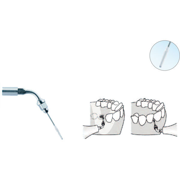 Punta ultrasonidos piezo implant kit profilaxis kavo