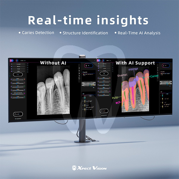 Sensor intraoral con lector de fotones xvd2530 imagen digital xpectvision
