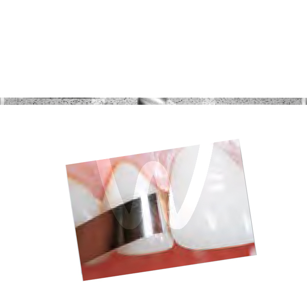 Tiras pulir ds37-0-k diamante komet reconstrucción komet