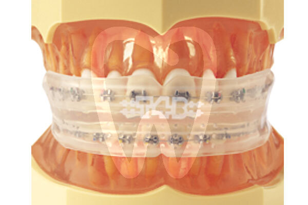 Trainer para brackets (t4b) transparente aparatos funcionales myofunctional